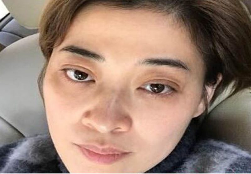 梅婷的黑眼圈为什么这么重