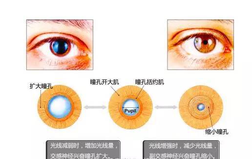 女子左眼瞳孔变大2倍找不到病因 白天畏光无法出门